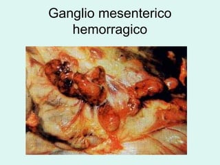 Ganglio mesenterico
   hemorragico
 