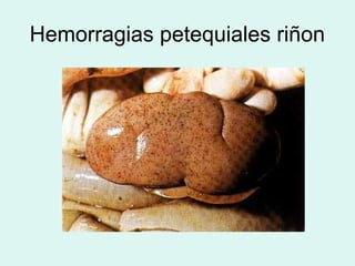 Hemorragias petequiales riñon
 