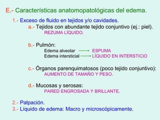 E.- Características anatomopatológicas del edema.
  1.- Exceso de fluido en tejidos y/o cavidades.
         a.- Tejidos con abundante tejido conjuntivo (ej.: piel).
                REZUMA LÍQUIDO.

         b.- Pulmón:
                Edema alveolar       ESPUMA
                Edema intersticial   LÍQUIDO EN INTERSTICIO

         c.- Órganos parenquimatosos (poco tejido conjuntivo):
                AUMENTO DE TAMAÑO Y PESO.

         d.- Mucosas y serosas:
                PARED ENGROSADA Y BRILLANTE.

  2.- Palpación.
  3.- Líquido de edema: Macro y microscópicamente.
 