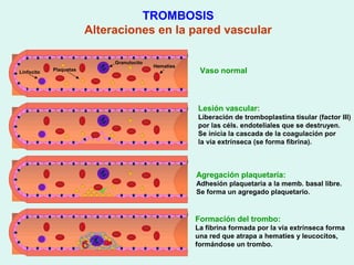 TROMBOSIS
                        Alteraciones en la pared vascular

                             Granulocito
                                           Hematíes
Linfocito   Plaquetas                                  Vaso normal



                                                      Lesión vascular:
                                                      Liberación de tromboplastina tisular (factor III)
                                                      por las céls. endoteliales que se destruyen.
                                                      Se inicia la cascada de la coagulación por
                                                      la vía extrínseca (se forma fibrina).



                                                      Agregación plaquetaria:
                                                      Adhesión plaquetaria a la memb. basal libre.
                                                      Se forma un agregado plaquetario.



                                                      Formación del trombo:
                                                      La fibrina formada por la vía extrínseca forma
                                                      una red que atrapa a hematíes y leucocitos,
                                                      formándose un trombo.
 