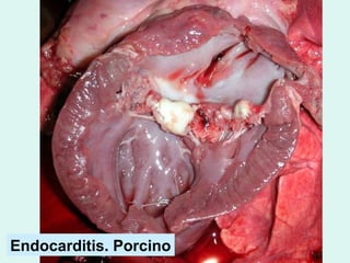 Endocarditis. Porcino
 