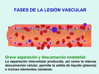 FASES DE LA LESIÓN VASCULAR




Grave separación y descamación endotelial:
La separación intercelular producida, así como la intensa
descamación celular, permite la salida de líquido (plasma)
e incluso elementos celulares.
 
