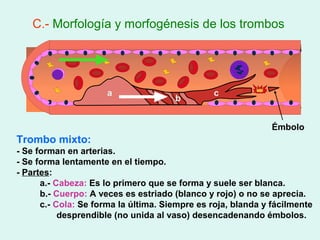 C.- Morfología y morfogénesis de los trombos




                      a                         c
                                      b


                                                              Émbolo
Trombo mixto:
- Se forman en arterias.
- Se forma lentamente en el tiempo.
- Partes:
      a.- Cabeza: Es lo primero que se forma y suele ser blanca.
      b.- Cuerpo: A veces es estriado (blanco y rojo) o no se aprecia.
      c.- Cola: Se forma la última. Siempre es roja, blanda y fácilmente
           desprendible (no unida al vaso) desencadenando émbolos.
 
