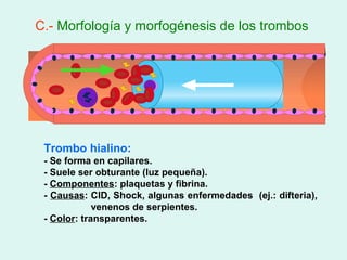 C.- Morfología y morfogénesis de los trombos




 Trombo hialino:
 - Se forma en capilares.
 - Suele ser obturante (luz pequeña).
 - Componentes: plaquetas y fibrina.
 - Causas: CID, Shock, algunas enfermedades (ej.: difteria),
             venenos de serpientes.
 - Color: transparentes.
 
