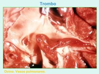 Trombo




Ovino. Vasos pulmonares.
 