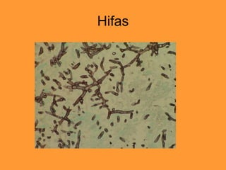 Hifas 