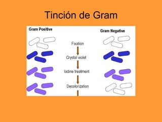 Tinción de Gram 