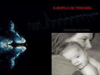 EJEMPLO DE TRISOMÍASÍNDROME DE DOWN