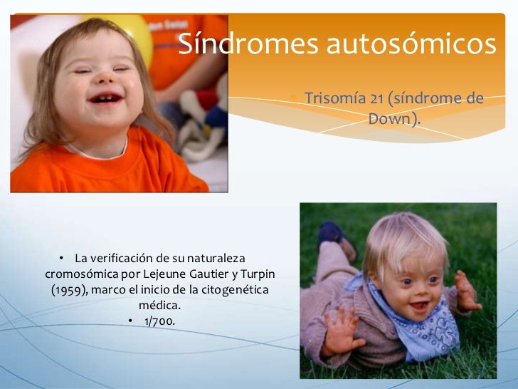 El Sindrome De Down Es Una Monosomia Y
