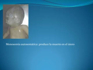 Monosomía autosomática: produce la muerte en el útero




        Monosomía autosomática: produce la muerte en el útero
 