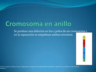Se produce una delecion en los 2 polos de un cromosoma y
                      en la reparación se empalman ambos extremos.




Guizar-Vazquez, Genética Clínica ,Diagnostico y manejo de las enfermedades hereditarias capitulo 8 y 9, 3ª edición , Edit. Manual
Moderno
 