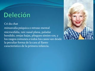 Cri du chat
minusvalía psíquica o retraso mental
microcefalia, raíz nasal plana, paladar
hendido, orejas bajas, pliegues simies-cos, y
los rasgos comunes a todos los casos van desde
la peculiar forma de la cara al llanto
característico de la primera infancia.
 