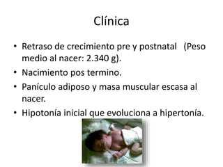 Clínica
• Retraso de crecimiento pre y postnatal (Peso
medio al nacer: 2.340 g).
• Nacimiento pos termino.
• Panículo adiposo y masa muscular escasa al
nacer.
• Hipotonía inicial que evoluciona a hipertonía.
 