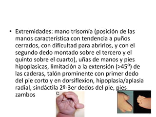 • Extremidades: mano trisomía (posición de las
manos característica con tendencia a puños
cerrados, con dificultad para abrirlos, y con el
segundo dedo montado sobre el tercero y el
quinto sobre el cuarto), uñas de manos y pies
hipoplasicas, limitación a la extensión (>45⁰) de
las caderas, talón prominente con primer dedo
del pie corto y en dorsiflexion, hipoplasia/aplasia
radial, sindáctila 2º-3er dedos del pie, pies
zambos
 