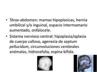 • Tórax-abdomen: mamas hipoplasicas, hernia
umbilical y/o inguinal, espacio intermamario
aumentado, onfalocele.
• Sistema nervioso central: hipoplasia/aplasia
de cuerpo calloso, agenesia de septum
pellucidum, circunvoluciones cerebrales
anómalas, hidrocefalia, espina bífida.
 