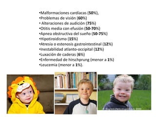 •Malformaciones cardíacas (50%),
•Problemas de visión (60%)
• Alteraciones de audición (75%)
•Otitis media con efusión (50-70%)
•Apnea obstructiva del sueño (50-75%)
•Hipotiroidismo (15%)
•Atresia o estenosis gastrointestinal (12%)
•Inestabilidad atlanto-occipital (12%)
•Luxación de caderas (6%)
•Enfermedad de hirschprung (menor a 1%)
•Leucemia (menor a 1%).
 