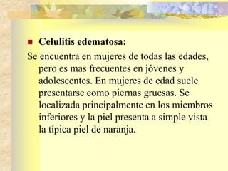  Celulitis edematosa: 
Se encuentra en mujeres de todas las edades, 
pero es mas frecuentes en jóvenes y 
adolescentes. En mujeres de edad suele 
presentarse como piernas gruesas. Se 
localizada principalmente en los miembros 
inferiores y la piel presenta a simple vista 
la típica piel de naranja. 
 