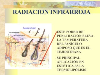 RADIACION INFRARROJA 
ESTE PODER DE 
PENETRACIÓN ELEVA 
LA TEMPERATURA 
DEL PANÍCULO 
ADIPOSO QUE ES EL 
TEJIDO DIANA 
SU PRINCIPAL 
APLICACIÓN EN 
ESTÉTICA ES LA 
TERMOLIPÓLISIS 
Epidermis 
Musculo erector 
de pelo 
Glandula 
sebácea 
Dermis 
Hipodermis 
Esquema de la piel 
Plexo arterial profundo Pelo 
Plexo arterial superficial 
Plexo venoso superficial 
Plexo venoso profundo 
 