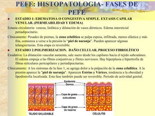 PEFE: HISTOPATOLOGIA- FASES DE 
PEFE 
 ESTADIO 1: EDEMATOSA O CONGESTIVA SIMPLE. EXTASIS CAPILAR 
VENULAR. (PERMEABILIDAD Y EDEMA) 
Ectasia circulatoria: venosa, linfática y dilatación de vasos dérmicos. Edema intersticial 
periadipocitario. 
Clínicamente: Pesadez de piernas, la zona celulítica se palpa espesa, infiltrada, menos elástica y más 
fría, comienza a verse a la presión la “piel de naranja”. Pueden aparecer algunas 
telangiectasias. Esta etapa es reversible. 
 ESTADIO 2:POLIMERIZACION. DAÑO CELULAR, PROCESO FIBROLÍTICO 
Exudativa: La dilatación vascular aumenta, sale suero desde los capilares hacia el tejido subcutáneo. 
El edema empuja a las fibras conjuntivas y filetes nerviosos. Hay hiperplasia e hipertrofia de 
fibras reticulares pericapilares y periadipocitarias. 
Clínicamente: A los síntomas de la fase 1, se agrega dolor a la palpación de la zona celulítica. A la 
presión aparece la "piel de naranja". Aparecen Estrías y Várices, tendencia a la obesidad y 
lipodistrofia localizada. Esta fase también puede ser reversible. Periodo de actividad genital. 
 