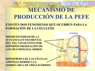MECANISMO DE 
PRODUCCIÓN DE LA PEFE 
EXISTEN DOS FENOMENOS QUE OCURREN PARA LA 
FORMACIÓN DE LA CELULITIS 
HIPERVISCOSIDAD DE LA 
SUSTANCIA FUNDAMENTAL 
DEL TEJ. CONJUNTIVO POR 
HIPERPOLIMERIZACIÓN DE 
LOS MUCOPOLISACÁRIDOS 
HIPERTROFIA DE LAS CÉLULAS 
ADIPOSAS DEBIDO A LA 
SOBRECARGA DE TRIGLICÉRIDOS 
La hipodermis 
Lóbulo graso 
Adipociti 
 