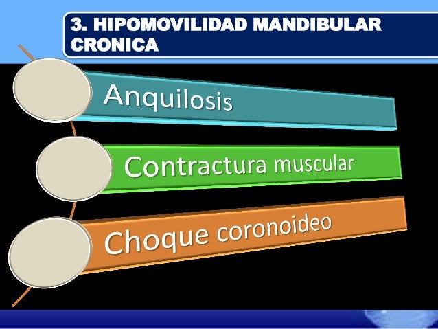 Alteraciones de la articulacion temporomandibular ATM Alteraciones de la articulacion temporomandibular ATM