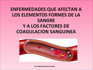 Dra. Nadia Meneses Gomez
ENFERMEDADES QUE AFECTAN A
LOS ELEMENTOS FORMES DE LA
SANGRE
Y A LOS FACTORES DE
COAGULACION SANGUINEA
 