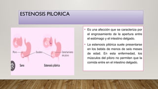 ALTERACIONES DEL APARATO DIGESTIVO lunes.pptx