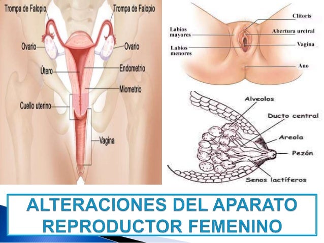 alteraciones del aparato reproductor femenino alteraciones uterinas