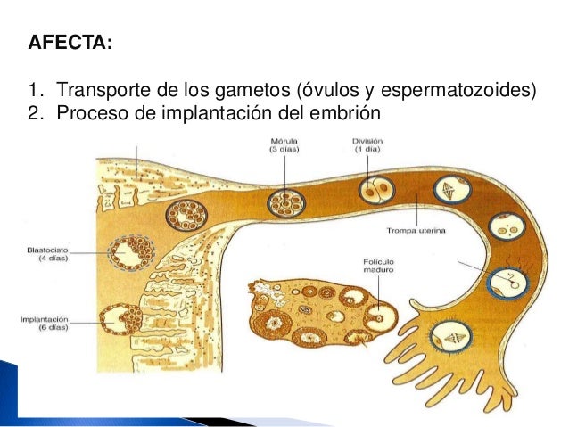 Alteraciones del aparato reproductor femenino- Alteraciones uterinas
