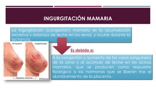 INGURGITACIÓN MAMARIA
La ingurgitación (congestión) mamaria es la acumulación
excesiva y dolorosa de leche en los senos, y ocurre durante la
lactancia.
Es debido a:
A la congestión y aumento de los vasos sanguíneos
de la zona y al acúmulo de leche en los acinos
mamarios, que se producen como respuesta
fisiológica a las hormonas que se liberan tras el
alumbramiento de la placenta.
 