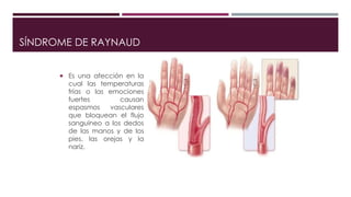 SÍNDROME DE RAYNAUD
 Es una afección en la
cual las temperaturas
frías o las emociones
fuertes causan
espasmos vasculares
que bloquean el flujo
sanguíneo a los dedos
de las manos y de los
pies, las orejas y la
nariz.
 