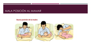 MALA POSICIÓN AL MAMAR
 