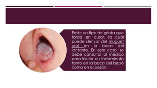 Existe un tipo de grieta que
tarda en curar, la cual
puede derivar del muguet
oral en la boca del
lactante. En este caso, se
debe consultar al médico
para iniciar un tratamiento
tanto en la boca del bebé
como en el pezón.
 