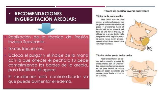 La sustitución de pecho implantov antes y después