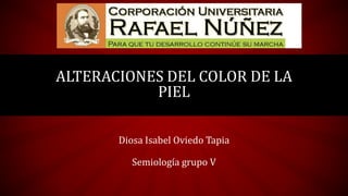 Diosa Isabel Oviedo Tapia
Semiología grupo V
ALTERACIONES DEL COLOR DE LA
PIEL
 