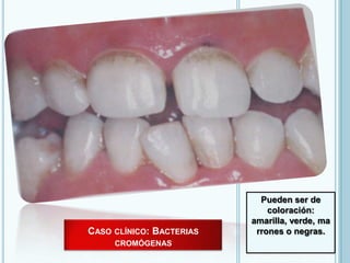 Alteraciones Del Color De Los Dientes PPTX alteraciones-del-color-de-los-dientes-pptx