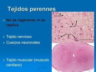 Tejidos perennes .
➢ No se regeneran ni se
replica
➢ Tejido nervioso
➢ Cuerpos neuronales
➢ Tejido muscular (musculo
cardiaco)
 