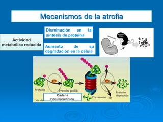 Mecanismos de la atrofia
Disminución en la
síntesis de proteína
Aumento de su
degradación en la célula
Actividad
metabólica reducida
Cadena
Poliubicuitínica
 