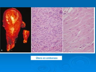 Útero en embarazo
 