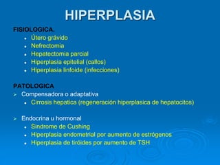 HIPERPLASIA
FISIOLOGICA.
⚫ Útero grávido
⚫ Nefrectomia
⚫ Hepatectomia parcial
⚫ Hiperplasia epitelial (callos)
⚫ Hiperplasia linfoide (infecciones)
PATOLOGICA
➢ Compensadora o adaptativa
⚫ Cirrosis hepatica (regeneración hiperplasica de hepatocitos)
➢ Endocrina u hormonal
⚫ Sindrome de Cushing
⚫ Hiperplasia endometrial por aumento de estrógenos
⚫ Hiperplasia de tiróides por aumento de TSH
 
