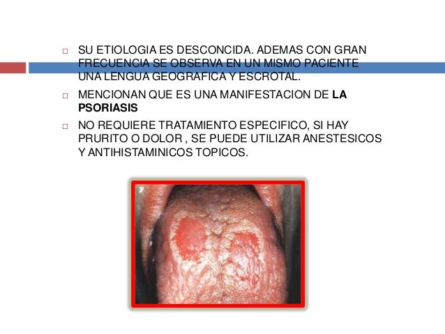 Alteraciones del desarrollo de la lengua