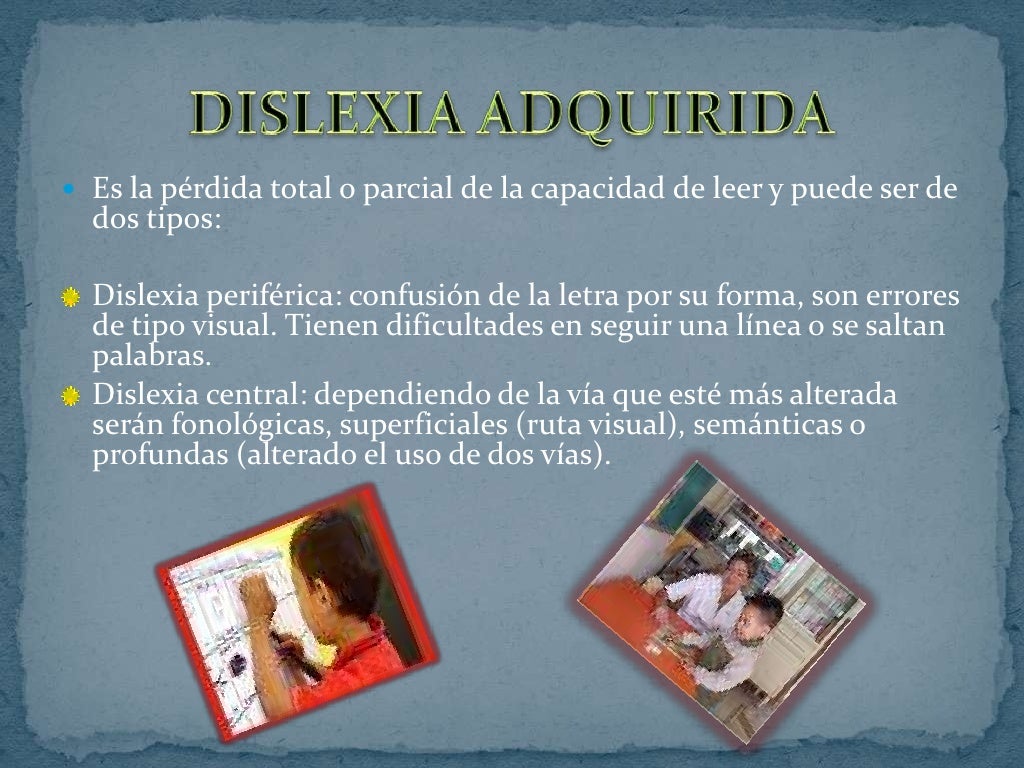 Alteraciones del lenguaje escrito