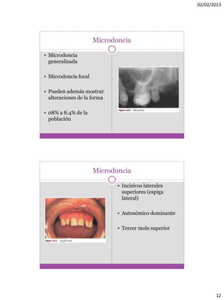 02/02/2013
12
Microdoncia
 Microdoncia
generalizada
 Microdoncia focal
 Pueden además mostrar
alteraciones de la forma
 08% a 8.4% de la
población
Microdoncia
 Incisivos laterales
superiores (espiga
lateral)
 Autosómico dominante
 Tercer mola superior
 