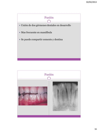 02/02/2013
16
Fusión
 Unión de dos gérmenes dentales en desarrollo
 Mas frecuente en mandíbula
 Se puede compartir cemento y dentina
Fusión
 