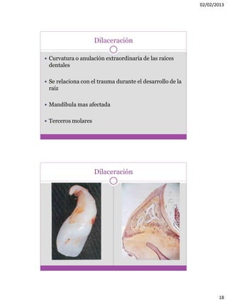 02/02/2013
18
Dilaceración
 Curvatura o anulación extraordinaria de las raíces
dentales
 Se relaciona con el trauma durante el desarrollo de la
raíz
 Mandíbula mas afectada
 Terceros molares
Dilaceración
 
