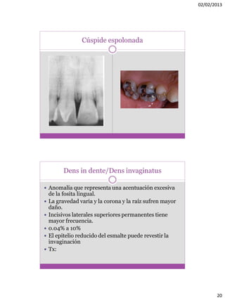 02/02/2013
20
Cúspide espolonada
Dens in dente/Dens invaginatus
 Anomalía que representa una acentuación excesiva
de la fosita lingual.
 La gravedad varia y la corona y la raíz sufren mayor
daño.
 Incisivos laterales superiores permanentes tiene
mayor frecuencia.
 0.04% a 10%
 El epitelio reducido del esmalte puede revestir la
invaginación
 Tx:
 