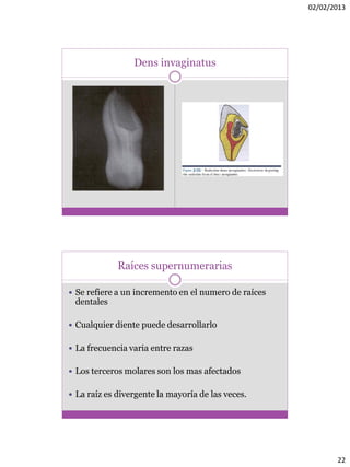 02/02/2013
22
Dens invaginatus
Raíces supernumerarias
 Se refiere a un incremento en el numero de raíces
dentales
 Cualquier diente puede desarrollarlo
 La frecuencia varia entre razas
 Los terceros molares son los mas afectados
 La raíz es divergente la mayoría de las veces.
 