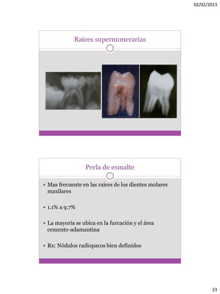 02/02/2013
23
Raíces supernumerarias
Perla de esmalte
 Mas frecuente en las raíces de los dientes molares
maxilares
 1.1% a 9.7%
 La mayoría se ubica en la furcación y el área
cemento-adamantina
 Rx: Nódulos radiopacos bien definidos
 