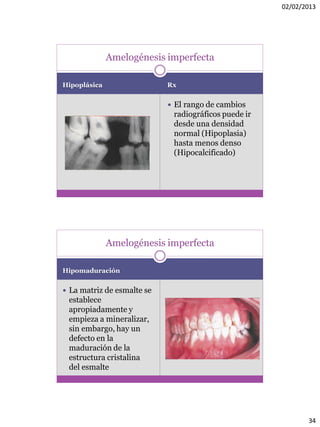 02/02/2013
34
Hipoplásica Rx
 El rango de cambios
radiográficos puede ir
desde una densidad
normal (Hipoplasia)
hasta menos denso
(Hipocalcificado)
Amelogénesis imperfecta
Hipomaduración
 La matriz de esmalte se
establece
apropiadamente y
empieza a mineralizar,
sin embargo, hay un
defecto en la
maduración de la
estructura cristalina
del esmalte
Amelogénesis imperfecta
 
