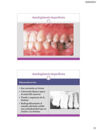 02/02/2013
35
Amelogénesis imperfecta
Hipomaduración
 Son normales en forma
 Coloración blanco opaco
al amarrillo marron
 Tiende a separarse de la
dentina
 Radiográficamente el
esmalte afectado exhibe
una radiodensidad que es
similar a la dentina.
Amelogénesis imperfecta
 